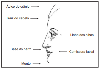 Q20.png 395×272