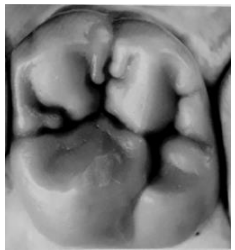 Q35.png 235×250