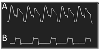 Q40.png 317×157