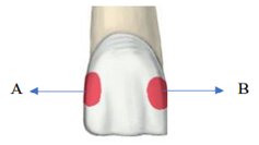 Q40.png 237×133