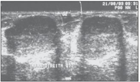 Q42.png 449×262