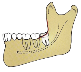 40.png 277×247