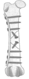 Q24.png 101×270