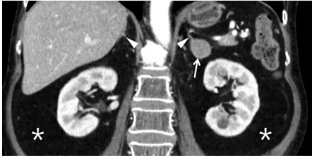 IMAGEM_26 RADIOLOGIA.png 442×222