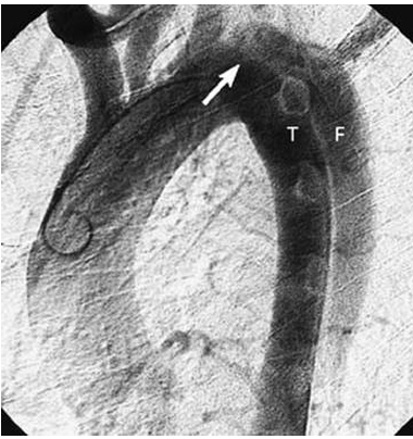 IMAGEM_23 RADIOLOGIA.png 380×404