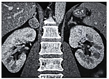 Q22.png 367×266