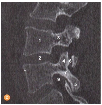 Q6.png 431×446