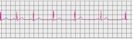 Q58.png 432×127