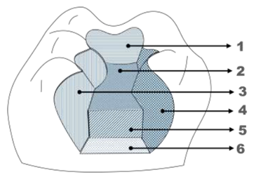 Q40.png 365×252
