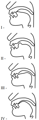 Q42.png 164×497