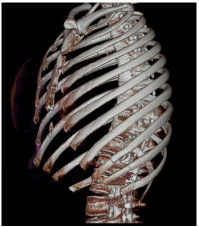 Captura_de tela 2025-11-18 172343.png 397×452
