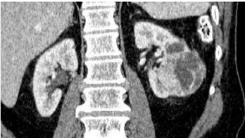 Q40__.png 348×196