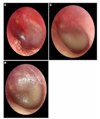 Captura_de tela 2026-04-16 095638.png 330×390