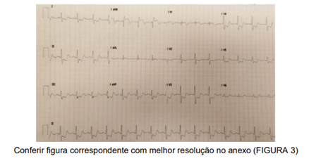 Q32.png 438×229