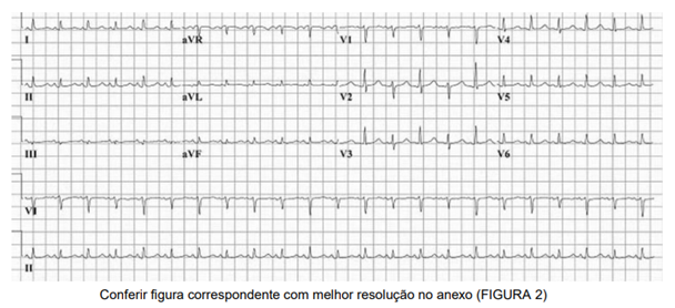 Q30.png 608×278