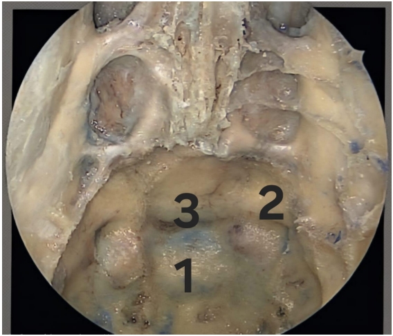 32.jpg 568×486