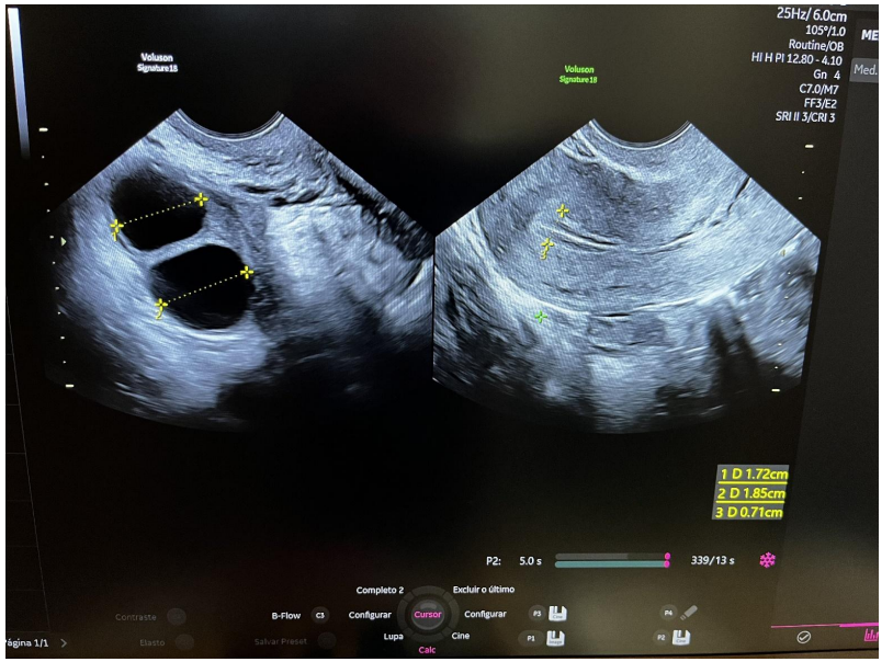 Captura_de tela 2026-03-06 151711.png 814×604