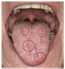 Q45.png 268×284