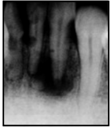 035.png 226×261