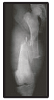 Q76.png 177×329
