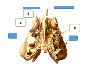 Q20.png 298×224