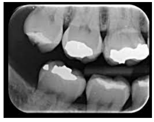 0_041.png 303×239