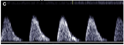 Q78.png 417×151