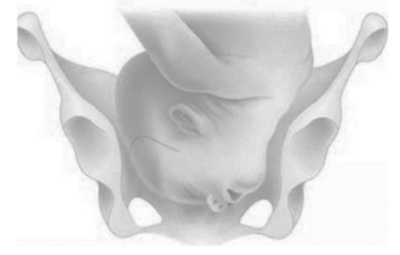 Q64.png 364×232
