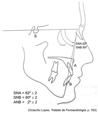 Q9.png 333×384