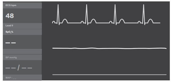 Q40.png 581×281