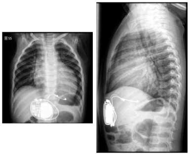 Captura_de tela 2025-04-03 131811.png 385×314