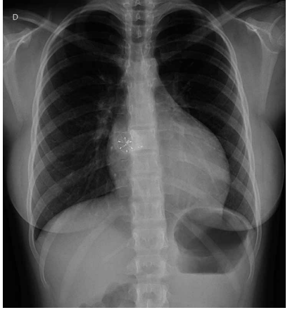 Captura_de tela 2025-04-03 131358.png 412×441
