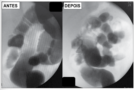Captura_de tela 2025-04-03 145114.png 435×290
