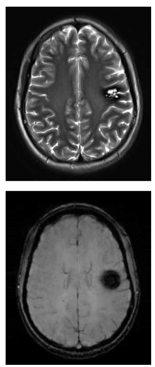 Q34.png 222×526