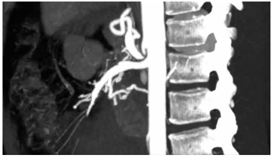 Captura_de tela 2026-04-01 103428.png 546×311